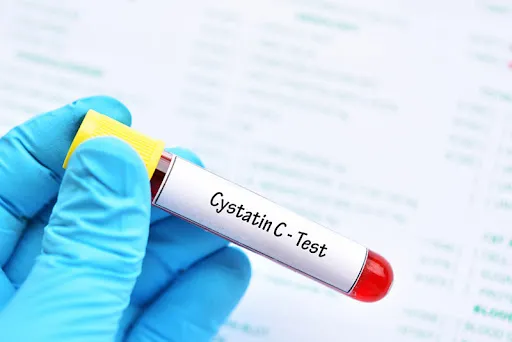 Cistatina C na prática clínica: quando a creatinina engana