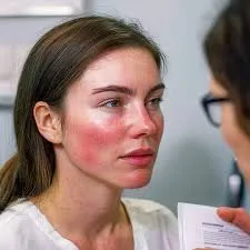 Desmame do corticoide na Nefrite Lúpica