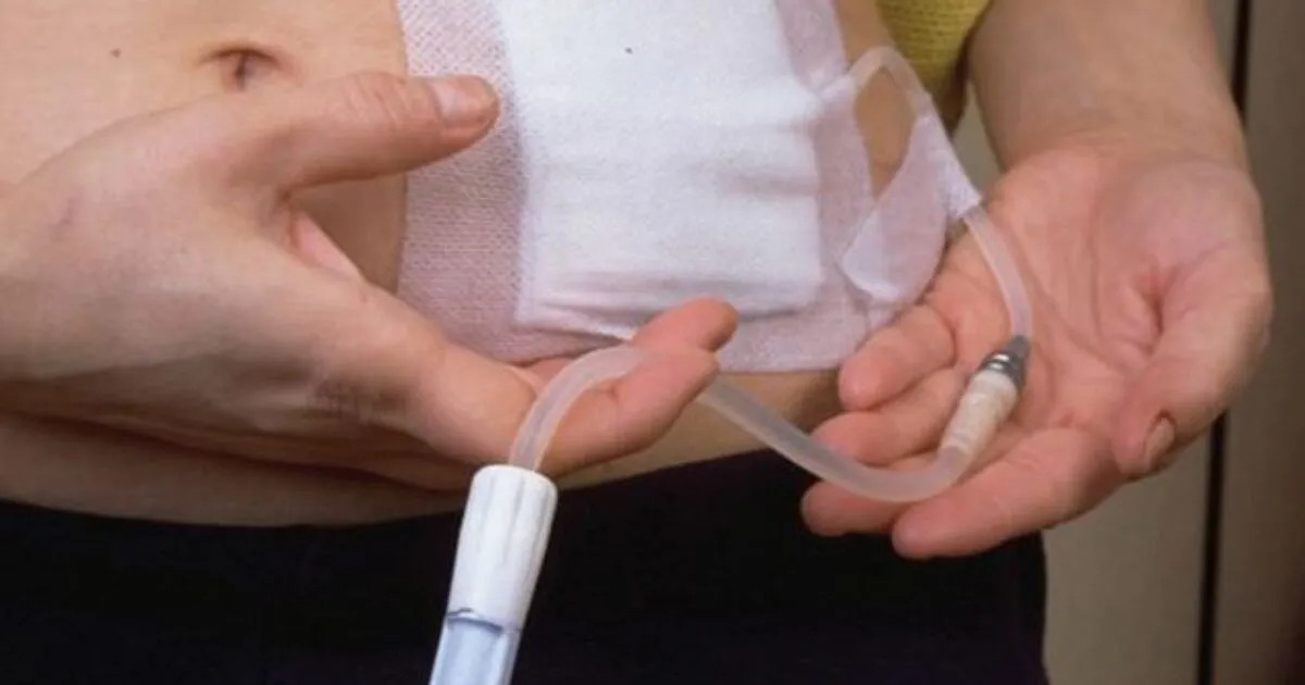 Diálise Peritoneal na Doença Renal Policística: existe algum motivo para não indicar?